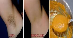 как избавиться от волос в зоне бикини народными средствами Vsego 2 Minuty I Nadoedlivye Volosy V Oblasti Podmyshek Ischeznut Nadolgo Headinsider Sredstva Dlya Udaleniya Volos Zdorove Udalenie Volos