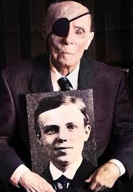 German WW1 veteran Hans Lange holds a portrait of himself as a 19 year old  in 1918. Born in 1899, Hans was wounded by a grenade during the war,  gradually losing his
