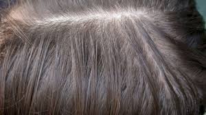 حبوب الحديد للشعر Hair Styles Iron Pills Long Hair Styles