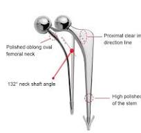 Orthopedic Implants Titanium Bipolar Hip Prosthesis Femoral ...