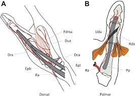 Vascular Anatomy Of The Hand In Relation To Flaps Hand Clinics