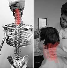 Blog Unsere Halswirbelsaule Chiropraktoren Neuer Weg