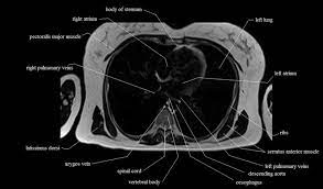 One particular feature of the digastric is that both bellies have different embryological origins. Chest Anatomy Mri Chest Thorax Axial Anatomy Free Cross Sectional Anatomy
