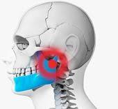 Pin On Tmj