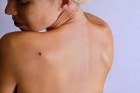 Abnormal cells grow and can form tumors. Skin Cancer Awareness Month How To Identify Skin Cancer U S Dermatology Partners Blog
