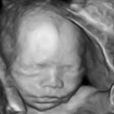 The head circumference at 20 weeks is between 15 to 20 centimeters in size. Week 20 Ultrasound What It Would Look Like Parents