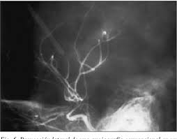 Criterios cadavéricos tanatorio criterios cardiorrespiratorios hospital c. Valor Diagnostico De La Angiografia Cerebral En La Confirmacion De La Muerte Encefalica Ventajas E Inconvenientes Semantic Scholar