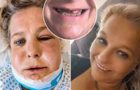 I ignored 'harmless' bloating for months until it was too late