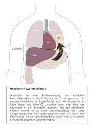 Angeborene Zwerchfellhernie Nach Der Op Neonatologie Padiatrische Intensivmedizin