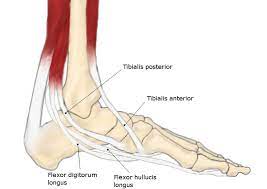 Posterior Tibial Tendon Dysfunction Somastruct Ankle Tendonitis Feet Posterior Tibial Tendonitis