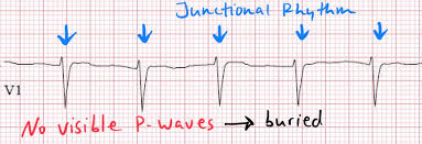 Image result for P Wave