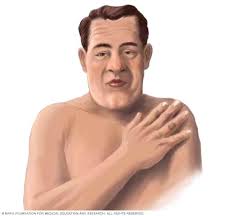 Image result for Acromegaly