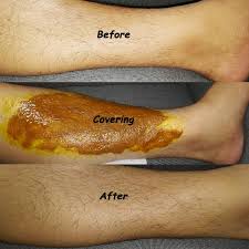 Find out the best hair removal cream for sensitive skin. Imaxcare On Twitter Is There Anybody Into Diy Hair Removal Cream You Might Need To Know How My Personal Tests Work On Arms Face And Legs Https T Co Nhg4ijyado Hairy Beforeandafter Honeyworks Lemonde Naturelovers