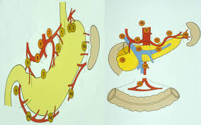 Worldwide it is one of the most common cancers. Surgical Oncology Stomach Cancer Surgery