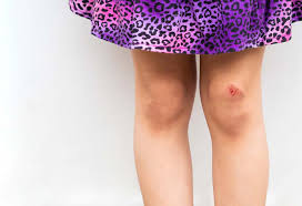 If it is a fungal or bacterial infection that is making the situation worse, it is likely that the application of the saltwater compress can effectively heal the condition faster. 10 Home Remedies To Heal Wounds And Cuts Faster