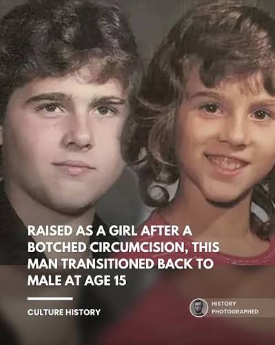 In 1966, David Reimer suffered a severe medical accident during a botched  circumcision.⁠ ⁠ Following the advice of psychologist Dr. John Money,  David's parents had him undergo sex reassignment surgery and raised