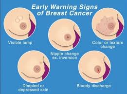 It is important that women finding an abnormal breast cancers may spread to other areas of the body and trigger other symptoms. Breast Cancer Awareness Types Symptoms Diagnosis Treatment