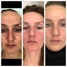 Stephanie Herold Beauty by Nerium