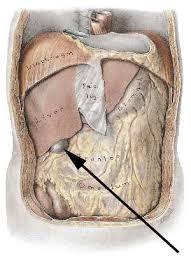 Magesår symptomer er plager man opplever som en følge av et sår i magen eller i første delen av tynntarmen, kalt tolvfingertarmen. Fakta Om Gallesten Nettdoktor