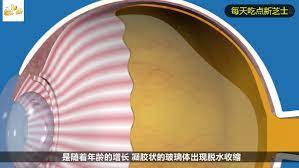 眼角 白色 分泌 物