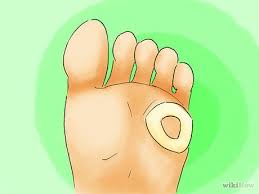 Calos Nos Pés Olho De Peixe How To Remove Corns From Your Toes Dedos Do Pe Calos Calos Nos Dedos