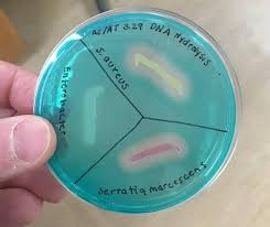 Biology of Microorganisms - DNase test is particularly useful for  identification of pathogenic staphylococci. Cultures of 3 species of  bacteria on DNase Agar with Methyl Green - incubated for 24h at 32C.