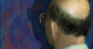 Super mom is using mep90 laser hair therapy treatments. Laser Comb Cloning To Re Grow Hair Cbs News