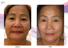 Sharon Main (skindeepperfect)