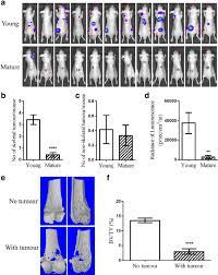 The earlier the detection of prostate cancer, the better the patient's chance of survival is. Comparison Of Skeletal Metastases By Human Prostate Cancer Cells In Download Scientific Diagram