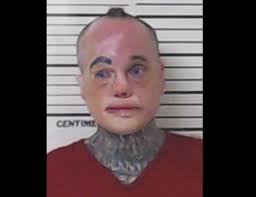 Texas Man With Disfigured Face Wanted for Murder