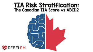 Image result for ABCD2 Score