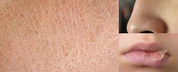 6 điều nên biết về da khô và da mất nước | Edbeauty