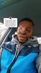 Aggressive Dog Pitbull Makes Eye Pop Out