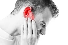 Tinnitus Va Rating 3m Military Earplugs Lawsuit