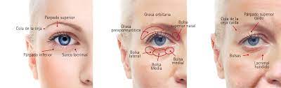 Eliminar Las Ojeras Hundidas O Hipercromia Idiopatica Del Anillo Orbitario