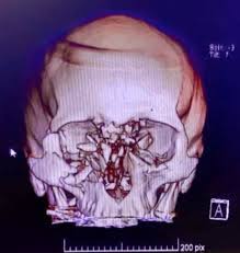 We did not find results for: Lareeca Auf Twitter Fabiola Campillay 36 Anos Madre De Un Nino De 8 Anos Iba A Su Trabajo Carabineros Le Lanzo Una Bomba Lacrimogena A La Cara En San Bernardo