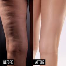 This is the newest place to search, delivering top results from across the web. People Are Saying This Secret Supplement Smooths Cellulite