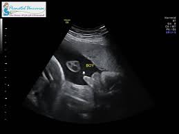 Jetzt revitive kaufen, gratis lieferung & 47,77€ ersparnis 3d Ultrasound Pricing Prenatal Universe Tacoma Wa