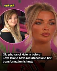 Bad body fillers procedure