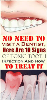 How can you fall asleep while experiencing a toothache? How To Sleep With Excruciating Toothache Arxiusarquitectura