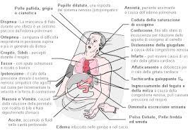 Noi pazienti con sintomi o trattamento per insufficienza cardiaca di miocardite e semafilo a quanto raccomandato per. Insufficienza Cardiaca