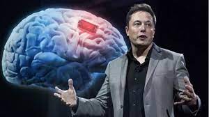 Bilionário Elon Musk anuncia primeiro implante de chip da Neuralink que  conecta cérebro humano a computador - Agenda Capital