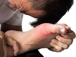 Pin On Crps