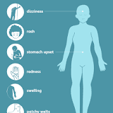 Image result for what is angioedema?