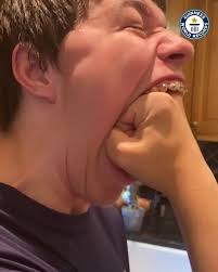 Open wide: Isaac Johnson (USA) has a mighty mouth gape record with a  measurement of 10.175 cm (4 in)