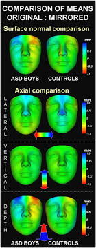 Learn more about autism spectrum disorders, symptoms, causes, diagnosis, and treatment. Face Brain Asymmetry In Autism Spectrum Disorders Molecular Psychiatry