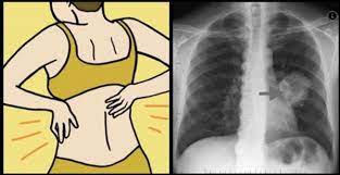 Selon lui, le cancer elles sont très agressives, métastasent rapidement, mais nous parvenons aujourd'hui à guérir environ 80% des patients, peu importe où se trouvent les. Attention Voici Les 8 Signes Du Cancer Sante Facile Magazine