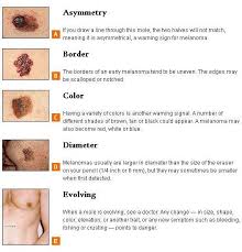 Describe several algorithms for evaluating melanocytic lesions by dermoscopy; Hideaway Spa Use Your Abcde To Spot Deadly Skin Cancer By Medicine Net As Pools And Beaches Beckon This Summer Be Sure To Protect Your Skin Against The Sun S Rays And