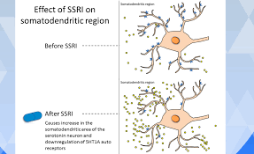 If you're taking an ssri for depression &/or anxiety, you are more likely to benefit than suffer, but there's no guarantee. Psychopharmacology Of Ssris Mechanism Of Action