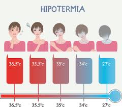 La actividad muscular incrementa transitoriamente la temperatura corporal. La Perdida De Calor Corporal Thetrekkinglife Com
